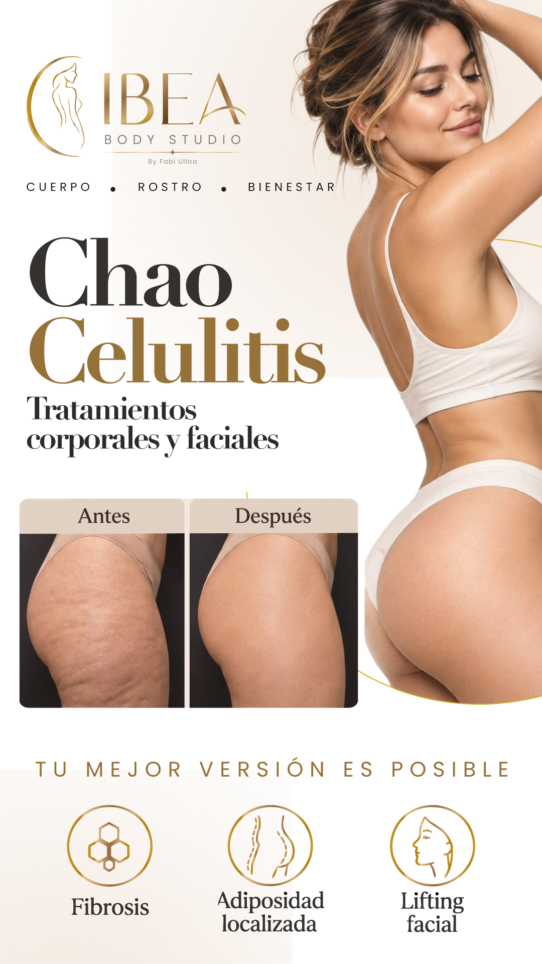Antes: fotografía de piernas del material promocional de IBEA